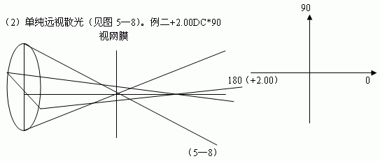 檢影驗(yàn)光三