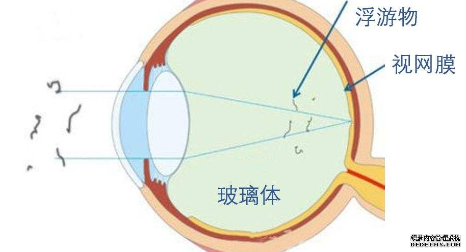 視力防控,視力加盟,視力品牌